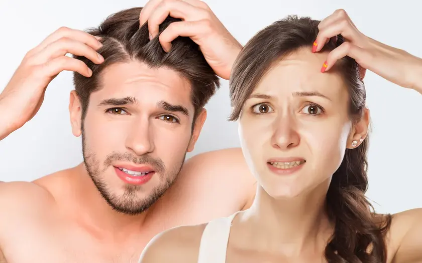 How To Get Rid Of Dandruff In Winter Naturally